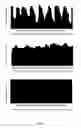 Fig. 05 - Apparatus, systems, and methods for treating obstructive sleep apnea