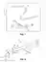 Fig. 04 - Intraperitoneal chemotherapy medical devices, kits, and methods