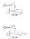 Fig. 09 - Intraperitoneal chemotherapy medical devices, kits, and methods