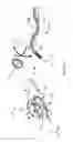 Fig. 33 - Input and articulation system for catheters and other uses