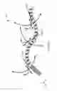 Fig. 35 - Input and articulation system for catheters and other uses