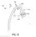 Fig. 09 - Lateral articulation anchors for catheters and other uses