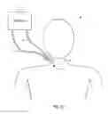 Fig. 02 - Cannula stabilization device