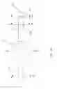 Fig. 20 - Occlusion catheter system and methods of use