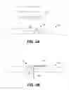 Fig. 03 - Apparatuses and methods for securing deep brain stimulation leads