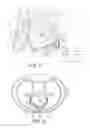 Fig. 02 - Extra-cardiovascular cardiac pacing system