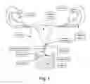 Fig. 02 - Devices, systems, and methods for treating obstetric and gynecological disorders