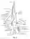 Fig. 03 - Devices, systems, and methods for treating obstetric and gynecological disorders