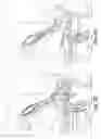 Fig. 05 - Devices, systems, and methods for treating obstetric and gynecological disorders