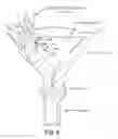 Fig. 09 - Devices, systems, and methods for treating obstetric and gynecological disorders