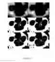Fig. 22 - Methods and systems for customizing cochlear implant stimulation and applications of same