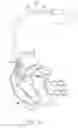 Fig. 02 - Systems and methods for intermittent multipoint pacing