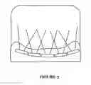 Fig. 04 - System and method for an electrical implant device with increased patient compliance