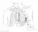 Fig. 01 - Tachyarrhythmia induction by an extra-cardiovascular implantable cardioverter defibrillator