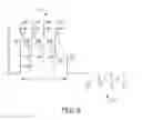Fig. 10 - Extra-cardiovascular pacing by an implantable cardioverter defibrillator