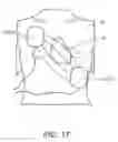 Fig. 15 - Systems, protective casings for smartphones, and associated methods to enhance use of an automated external defibrillator (AED) device