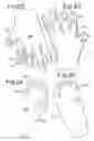 Fig. 12 - Radiation treatment sheet devices and methods