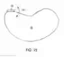 Fig. 14 - COLLIMATOR AND ENERGY DEGRADER