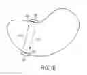 Fig. 15 - COLLIMATOR AND ENERGY DEGRADER