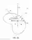 Fig. 17 - COLLIMATOR AND ENERGY DEGRADER
