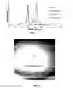Fig. 04 - Visualizing Radiation Therapy Beam in Real-Time in the context of Patient's Anatomy