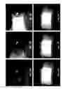 Fig. 06 - Visualizing Radiation Therapy Beam in Real-Time in the context of Patient's Anatomy