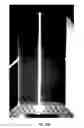 Fig. 09 - Visualizing Radiation Therapy Beam in Real-Time in the context of Patient's Anatomy