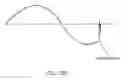 Fig. 17 - SYSTEMS, DEVICES, AND METHODS FOR PULMONARY TREATMENT