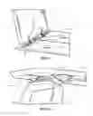 Fig. 07 - Stove top fire extinguishing device