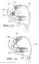 Fig. 07 - Golf club head having movable weights