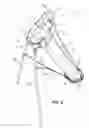 Fig. 03 - Sub-assembly for a golf bag and a golf bag system for recipient self-assembly