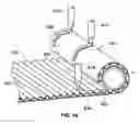 Fig. 11 - Filter media and filter element with adhesive reinforcing