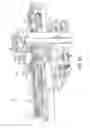 Fig. 05 - Laser machining systems and methods with vision correction and/or tracking