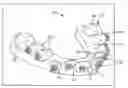 Fig. 01 - RAPID PROTOTYPED TRANSFER TRAY FOR ORTHODONTIC APPLIANCES
