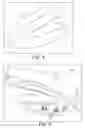 Fig. 06 - RAPID PROTOTYPED TRANSFER TRAY FOR ORTHODONTIC APPLIANCES