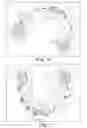 Fig. 07 - RAPID PROTOTYPED TRANSFER TRAY FOR ORTHODONTIC APPLIANCES