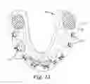Fig. 10 - RAPID PROTOTYPED TRANSFER TRAY FOR ORTHODONTIC APPLIANCES