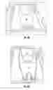 Fig. 05 - PLANAR END EFFECTOR AND METHOD OF MAKING A PLANAR END EFFECTOR
