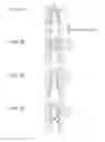 Fig. 08 - Liquid ejection head and liquid ejection apparatus