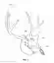 Fig. 02 - Trophy mount and skull clamp