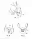Fig. 08 - Trophy mount and skull clamp