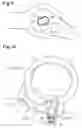 Fig. 09 - SEAT RECLINING DEVICE FOR VEHICLE