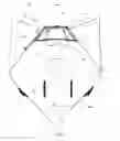 Fig. 03 - Body support system