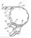Fig. 01 - Snap-on position limiter for a conveyor belt