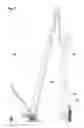 Fig. 09 - Hoisting frame for overweight lifting