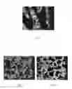 Fig. 02 - Method for producing porous calcium deficient hydroxyapatite granules