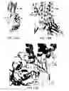 Fig. 18 - Antibody cytokine engrafted compositions and methods of use for immunoregulation