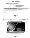 Fig. 04 - MODULATING DISEASE THROUGH GENETIC ENGINEERING OF PLANTS