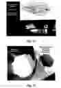 Fig. 09 - MODULATING DISEASE THROUGH GENETIC ENGINEERING OF PLANTS