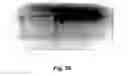 Fig. 78 - MODULATING DISEASE THROUGH GENETIC ENGINEERING OF PLANTS